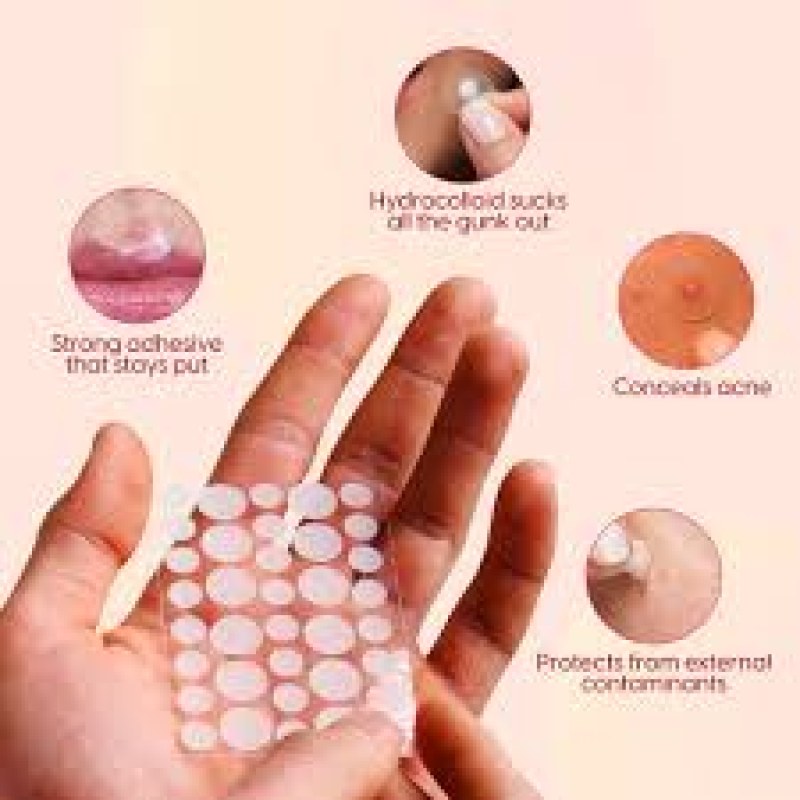 1720 PIMPLE PATCH 36PCS- 1 SET